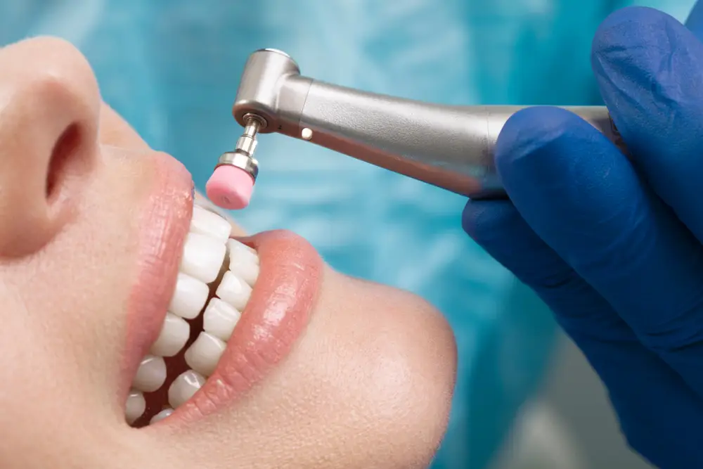 Dental Cleaning
