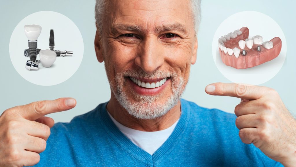 Dental Implants