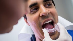 Invisalign